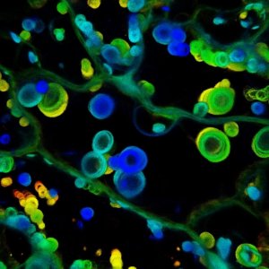 Image d’une cellule végétale observée au microscope confocal. La couleur indique l'accumulation d'un facteur de virulence de champignon dans la plante.