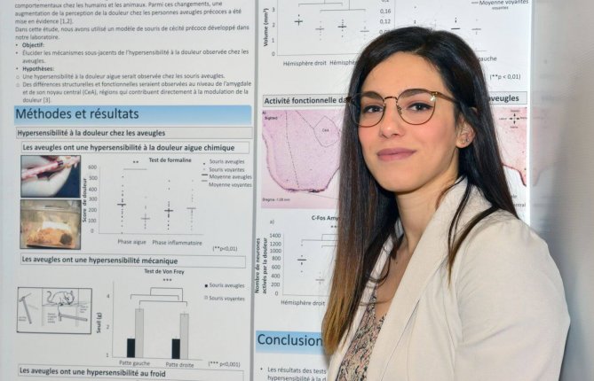 Sensibilité à la douleur, fonction olfactive et plasticité cérébrale chez un modèle murin de cécité congénitale